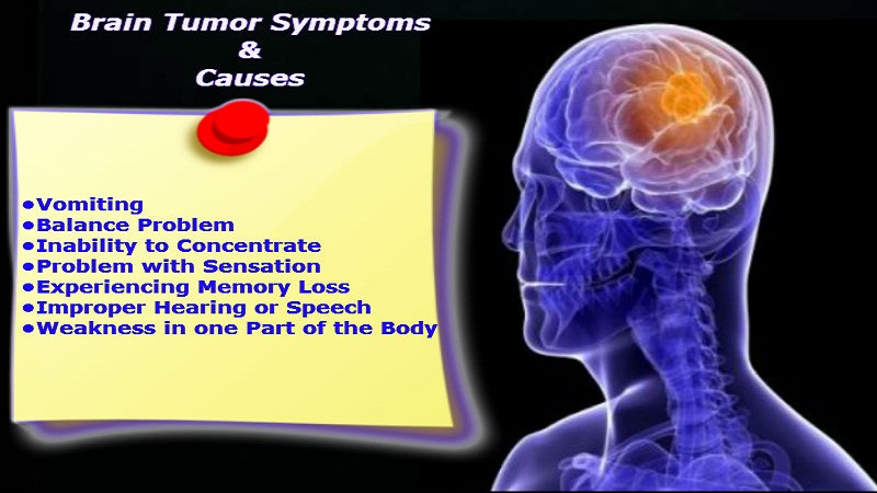 Meningiomas brain tumor