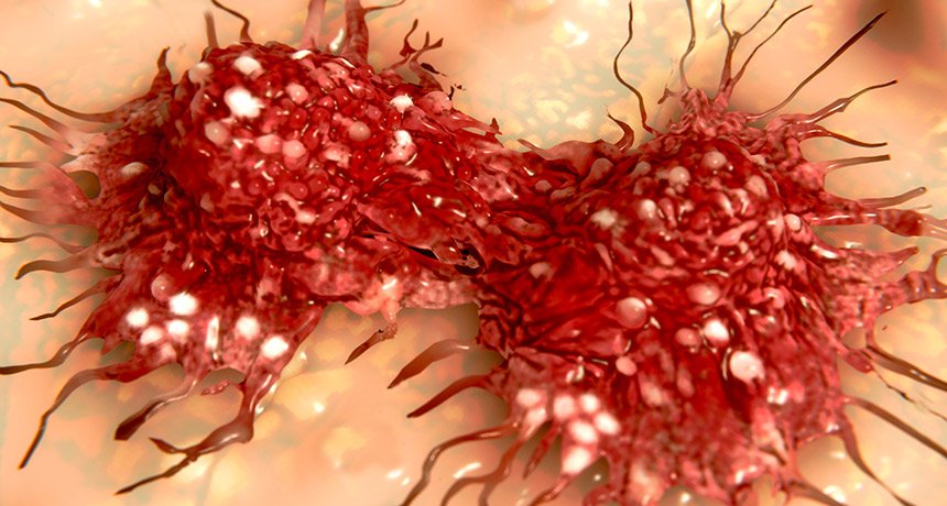 CANCER | MetroHealth HMO